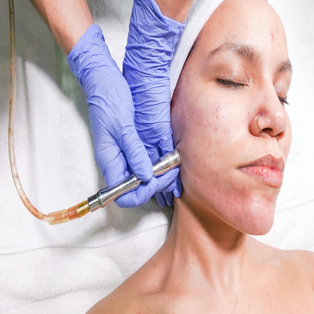 Spa điều trị mụn chuyên sâu với thao tác nhẹ nhàng