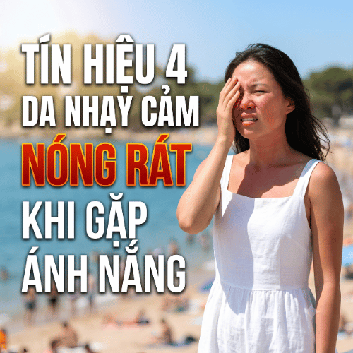Tin hieu 4 da nhay cam nong rat khi gap anh nang
