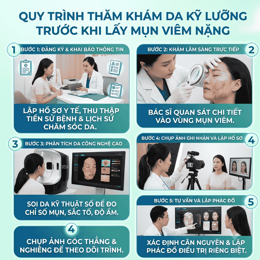 Quy trình thăm khám da kỹ lưỡng trước khi lấy mụn viêm nặng.